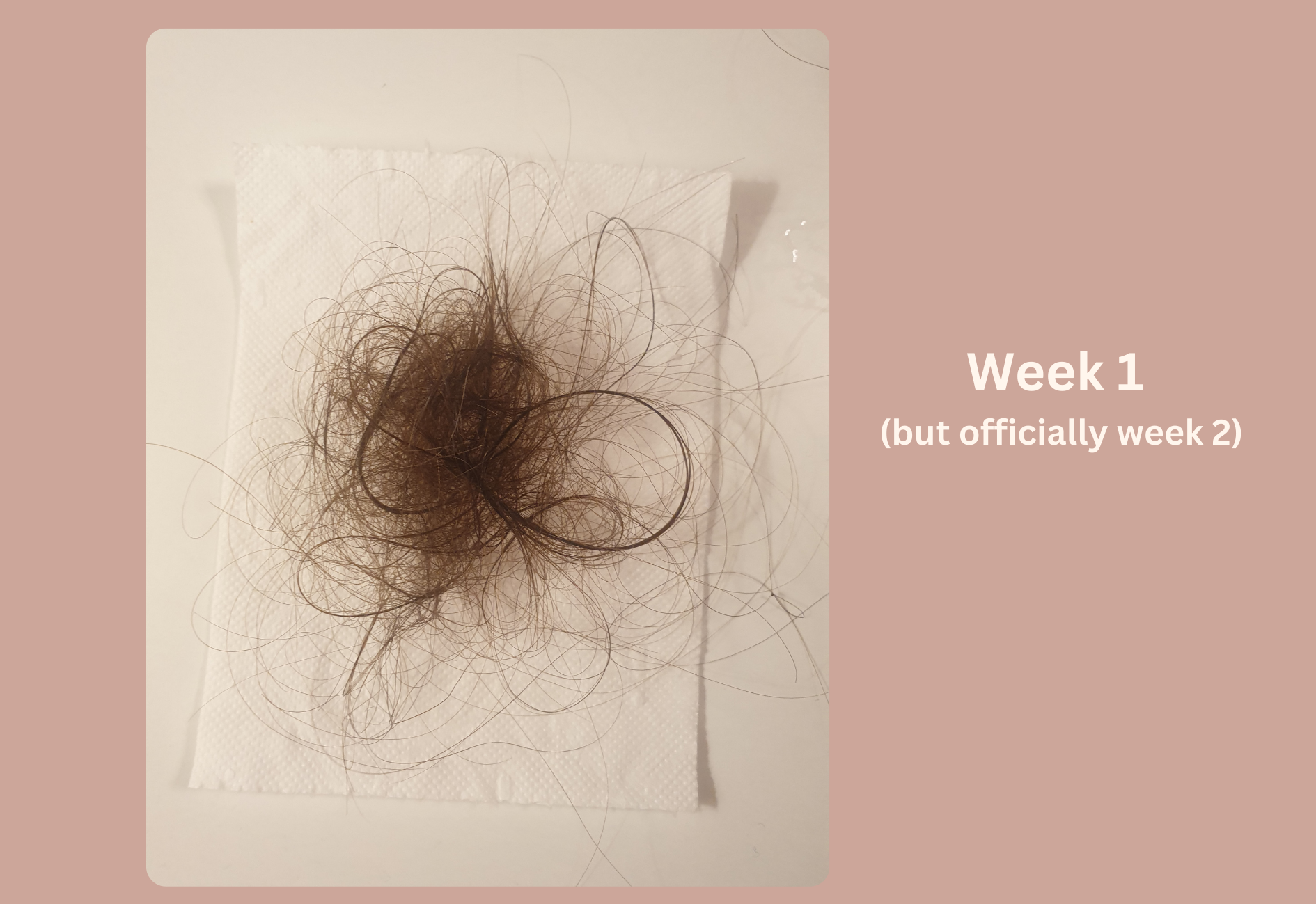 Seasonal hair loss progress during the first week