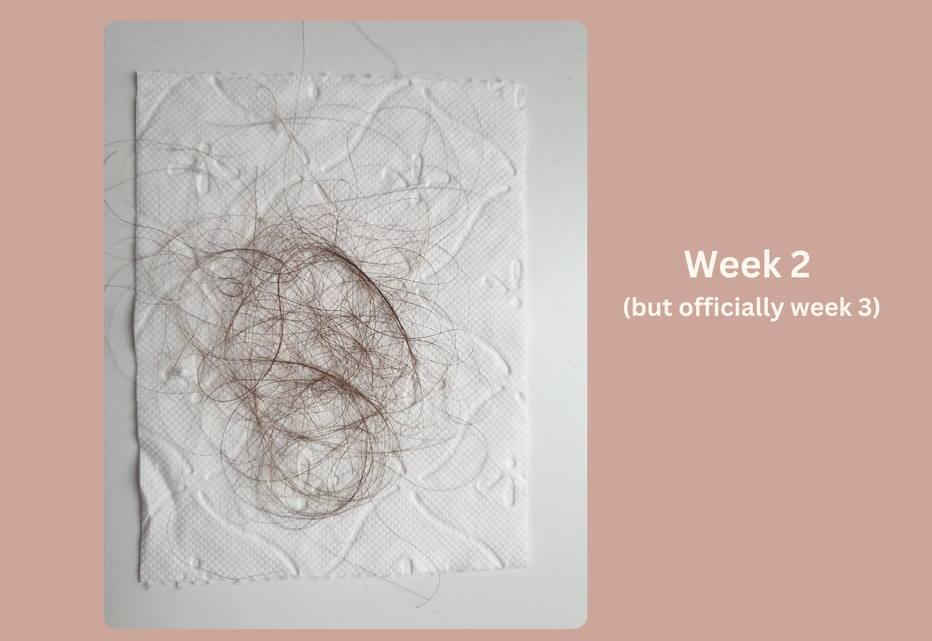 Seasonal hair loss progress during the second week