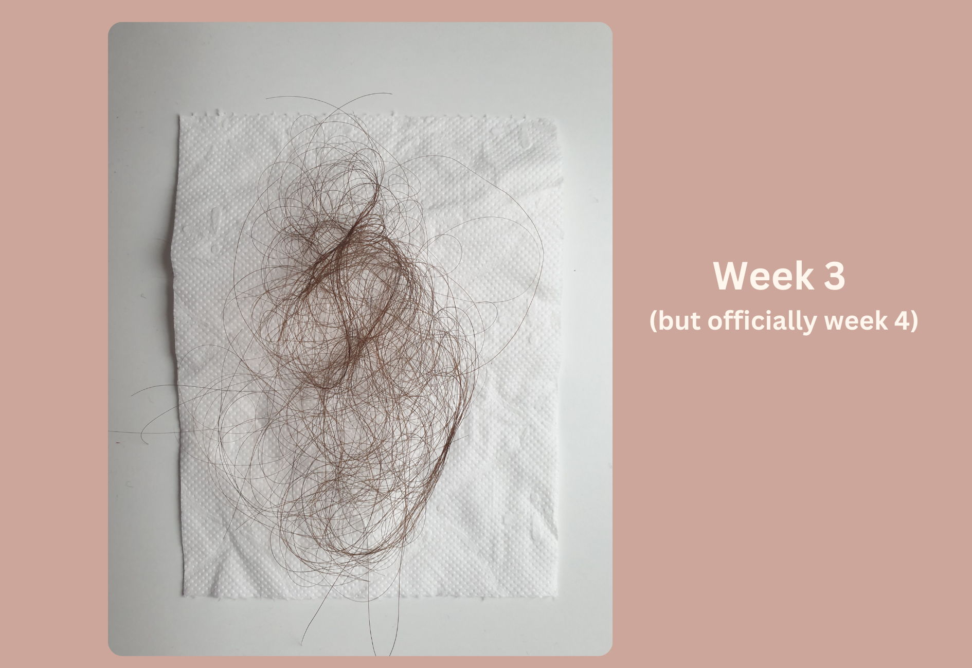 Seasonal hair loss progress during the third week