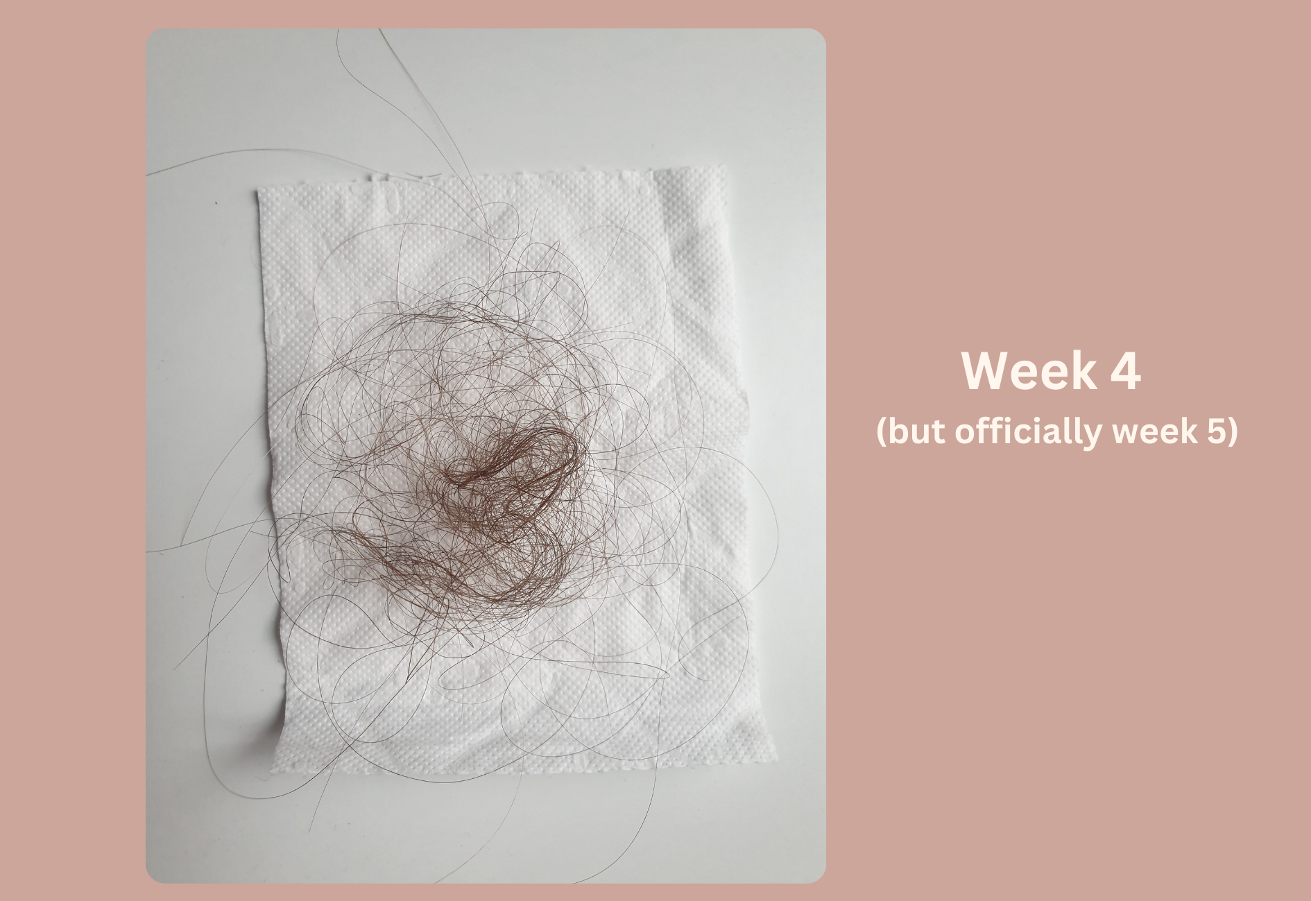 Seasonal hair loss progress during the fourth week